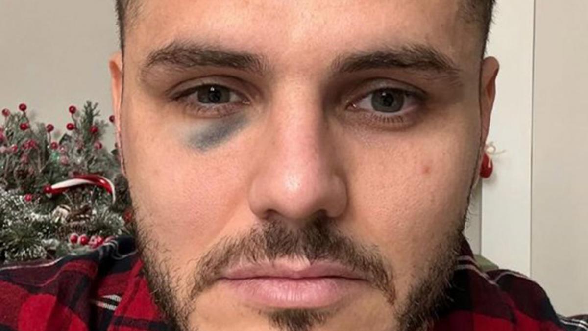 Icardi terminó con un ojo morado y Galatasaray denunció manipulación del VAR