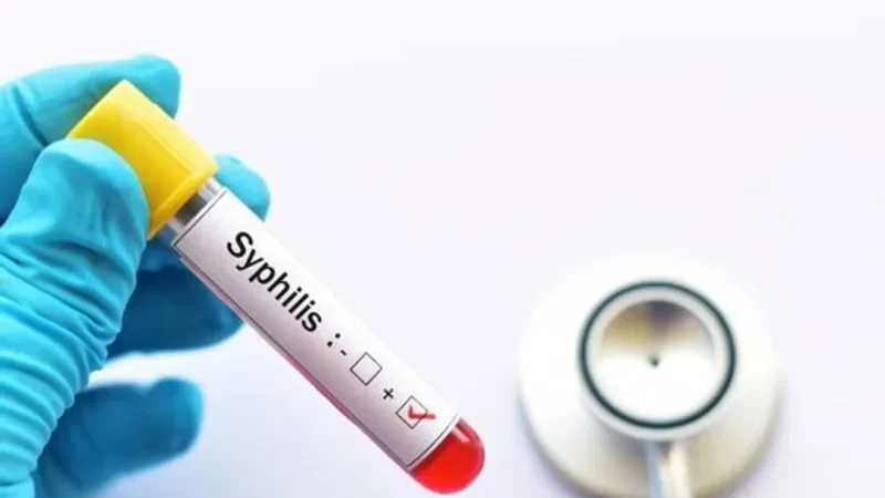 Alerta sífilis: en 2025 hubo más de 46.000 casos